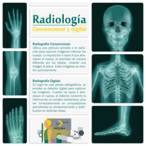 Lee más sobre el artículo Radiografías